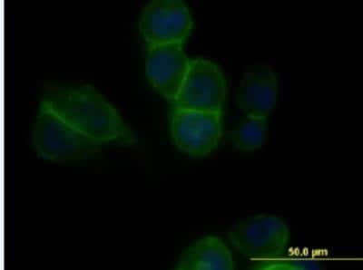Immunocytochemistry/ Immunofluorescence: Cadherin-11 Antibody (3C8) [H00001009-M05-100ug]