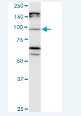 Western Blot: Cadherin-11 Antibody (3C8) [H00001009-M05-100ug]