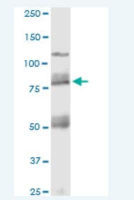 Western Blot: Cadherin-11 Antibody (3C8) [H00001009-M05-100ug]