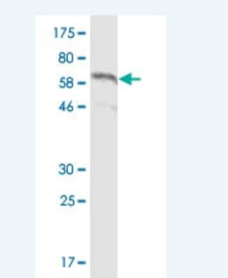 Western Blot: Cadherin-11 Antibody (3C8) [H00001009-M05-100ug]