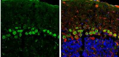 Immunohistochemistry-Frozen: Cadherin-11 Antibody [NBP2-15661]