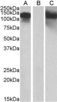 Western Blot: Cadherin-11 Antibody [NBP1-52046]