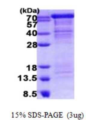 SDS-PAGE: Recombinant Human Cadherin-11 His Protein [NBP2-22722]