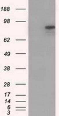Western Blot: Cadherin-13 Antibody (OTI3H6) [NBP2-02528]