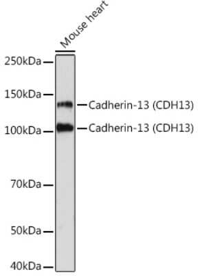 Western Blot: Cadherin-13 Antibody (4Z8D1) [NBP3-16158]