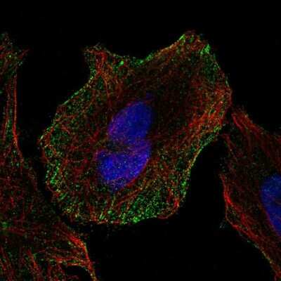 Immunocytochemistry/ Immunofluorescence: Cadherin-13 Antibody [NBP1-85708]