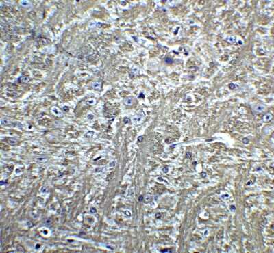 Immunohistochemistry: Cadherin-13 Antibody - BSA Free [NBP2-26611]