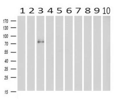 Western Blot: Cadherin-13 Antibody (OTI3H6) [NBP2-02528]