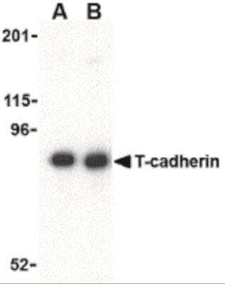 Western Blot: Cadherin-13 AntibodyBSA Free [NBP2-26611]