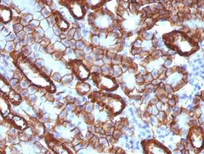 Immunohistochemistry-Paraffin: Cadherin-16 Antibody (CDH16/1071) - Azide and BSA Free [NBP2-47745]