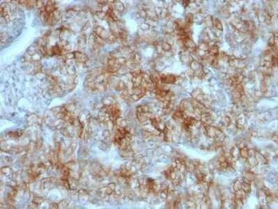 Immunohistochemistry-Paraffin: Cadherin-16 Antibody (CDH16/1071) - Azide and BSA Free [NBP2-47745]