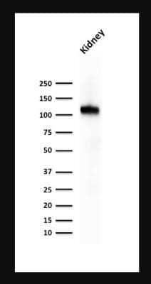 Western Blot: Cadherin-16 Antibody (CDH16/1071)Azide and BSA Free [NBP2-47745]