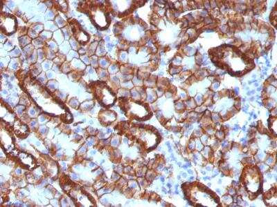 Immunohistochemistry-Paraffin: Cadherin-16 Antibody (CDH16/1071) - IHC-Prediluted [NBP2-48433]
