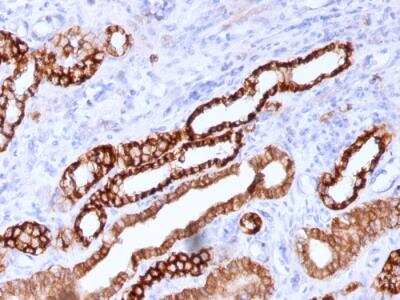 Immunohistochemistry-Paraffin: Cadherin-16 Antibody (CDH16/1071) - IHC-Prediluted [NBP2-48433]