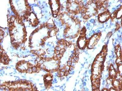 Immunohistochemistry-Paraffin: Cadherin-16 Antibody (CDH16/1532R) - Azide and BSA Free [NBP2-54567]