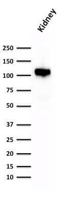 Western Blot: Cadherin-16 Antibody (CDH16/1532R)Azide and BSA Free [NBP2-54567]