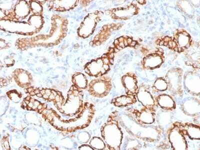 Immunohistochemistry-Paraffin: Cadherin-16 Antibody (CDH16/1532R) [NBP2-53221]