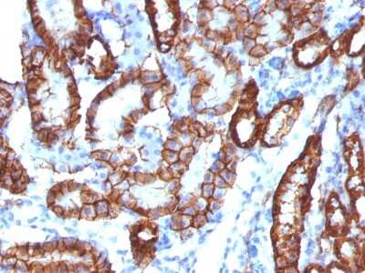 Immunohistochemistry-Paraffin: Cadherin-16 Antibody (CDH16/1532R) [NBP2-53221]