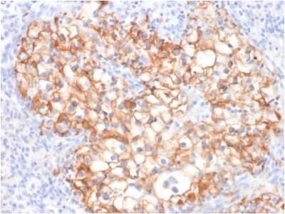 Immunohistochemistry-Paraffin: Cadherin-16 Antibody (CDH16/2125) - Azide and BSA Free [NBP2-79856]