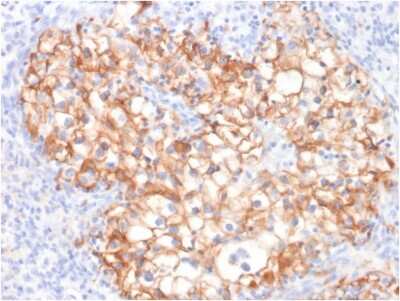Immunohistochemistry-Paraffin: Cadherin-16 Antibody (CDH16/2125) - Azide and BSA Free [NBP2-79856]