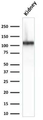 Western Blot: Cadherin-16 Antibody (CDH16/2125)Azide and BSA Free [NBP2-79856]