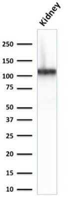 Western Blot: Cadherin-16 Antibody (CDH16/2125) [NBP2-79722]