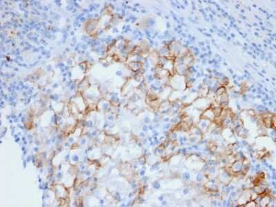 Immunohistochemistry-Paraffin: Cadherin-16 Antibody (CDH16/2448) - Azide and BSA Free [NBP3-08959]