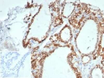 Immunohistochemistry-Paraffin: Cadherin-16 Antibody (CDH16/7027R) [NBP3-13828]