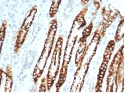 Immunohistochemistry-Paraffin: Cadherin-16 Antibody (CDH16/7028R) [NBP3-13829]
