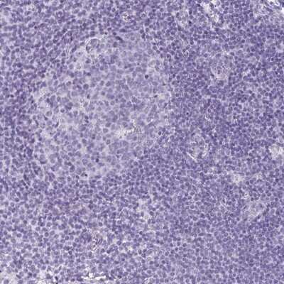 Immunohistochemistry-Paraffin: Cadherin-16 Antibody [NBP2-34028]