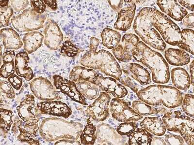 Immunohistochemistry-Paraffin: Cadherin-16 Antibody [NBP2-99664]