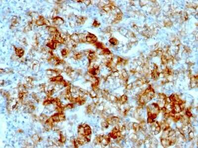 Immunohistochemistry-Paraffin: Cadherin-16 Antibody (SPM594) - Azide and BSA Free [NBP2-47746]