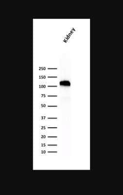 Western Blot: Cadherin-16 Antibody (SPM594)Azide and BSA Free [NBP2-47746]