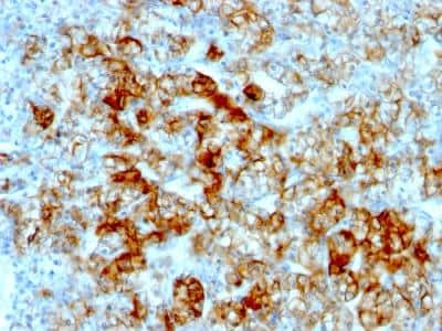 Immunohistochemistry-Paraffin: Cadherin-16 Antibody (SPM594) - IHC-Prediluted [NBP2-48155]