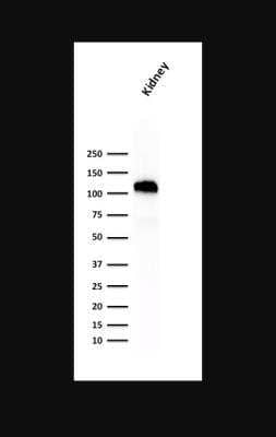 Western Blot: Cadherin-16 Antibody (SPM594) [NBP2-45158]