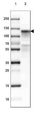 Western Blot: Cadherin-16 Antibody [NBP2-34028]