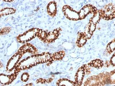 Immunohistochemistry-Paraffin: Cadherin-16 Antibody (rCDH16/1071) - Azide and BSA Free [NBP3-08881]
