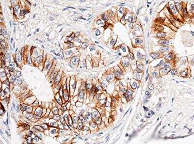 Immunohistochemistry-Paraffin: Cadherin-17 Antibody (029) [NBP2-89891]