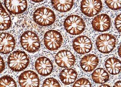 Immunohistochemistry-Paraffin: Cadherin-17 Antibody (029) [NBP2-89891]