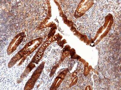 Immunohistochemistry-Paraffin: Cadherin-17 Antibody (029) [NBP2-89891]