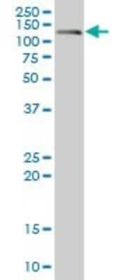 Western Blot: Cadherin-17 Antibody (1H3) [H00001015-M01]