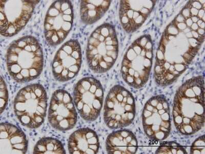 Immunohistochemistry-Paraffin: Cadherin-17 Antibody (3H2) [H00001015-M03]