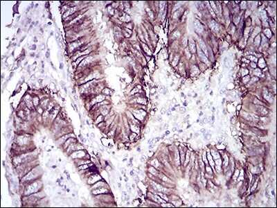 Immunohistochemistry-Paraffin: Cadherin-17 Antibody (7D10E1) - BSA Free [NBP2-52439]