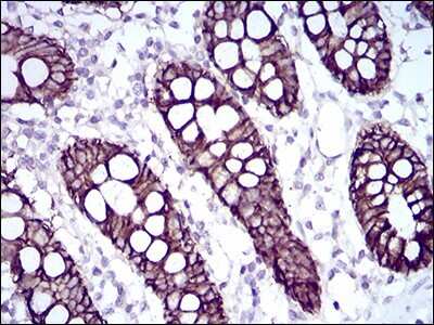 Immunohistochemistry-Paraffin: Cadherin-17 Antibody (7D10E1) - BSA Free [NBP2-52439]