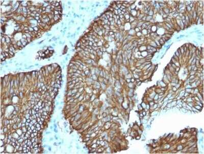 Immunohistochemistry-Paraffin: Cadherin-17 Antibody (CDH17/2618) - BSA Free [NBP2-79857]