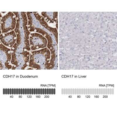 Immunohistochemistry-Paraffin: Cadherin-17 Antibody [NBP1-88237]