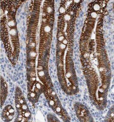 Immunohistochemistry-Paraffin: Cadherin-17 Antibody [NBP1-88238]