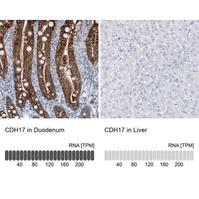 Immunohistochemistry-Paraffin: Cadherin-17 Antibody [NBP1-88238]