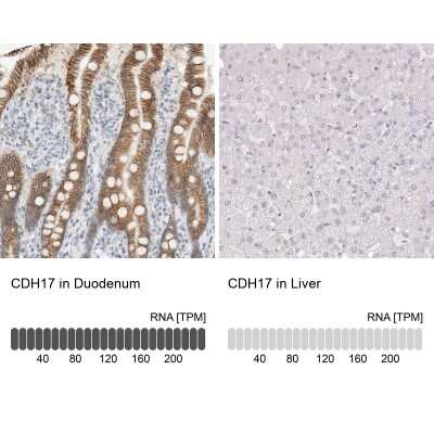 Immunohistochemistry-Paraffin: Cadherin-17 Antibody [NBP1-88239]