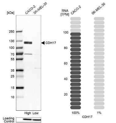 Western Blot: Cadherin-17 Antibody [NBP1-88237]